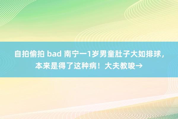 自拍偷拍 bad 南宁一1岁男童肚子大如排球，本来是得了这种病！大夫教唆→